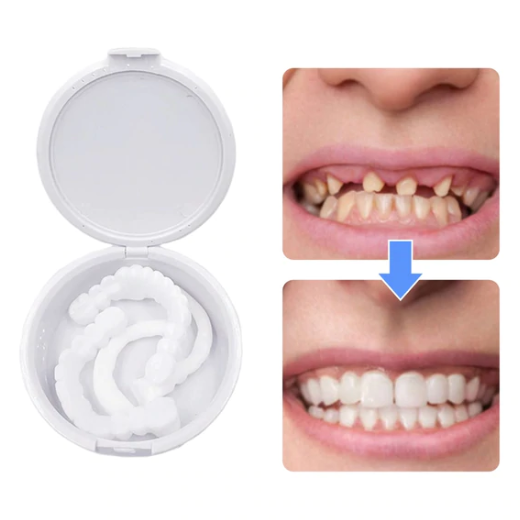 Snap On Smile Top And Bottom Clip on Teeth Veneers
