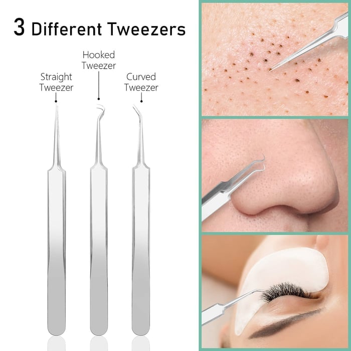 Professional Facial Blackhead Remover Pimple Popper Tool Kit