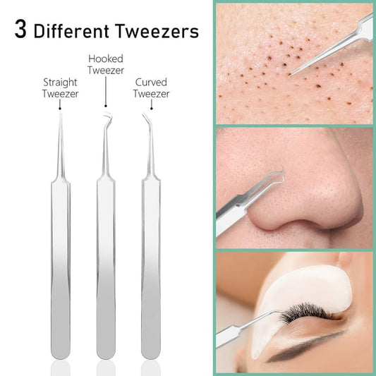 Professional Facial Blackhead Remover Pimple Popper Tool Kit